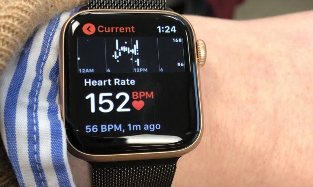 Apple Watch Saves Life of Woman Who Didn’t Even Notice She Had a Heart Attack