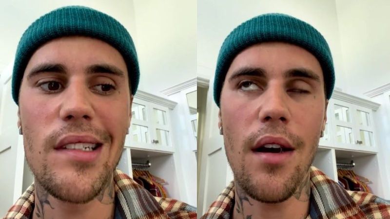 “Body is telling me I got to slow down” Justin Bieber on Having ‘Partial Face Paralysis’