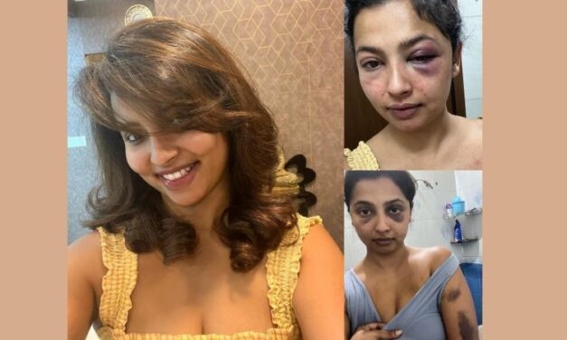 Malayalam Actor Anicka Alleges Ex-BF of Physical Assault, Shares Pictures of Bruised Face on FB