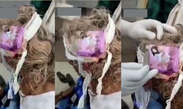 Video: MP Woman’s Head Wound Gets Dressed with Condom Pack, Dresser Transferred