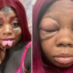 Woman Losing Eyesight After Getting Eyeballs Tattooed, Goes Against Daughter’s Advice
